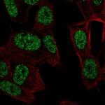 RALYL Antibody in Immunocytochemistry (ICC/IF)