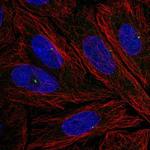 NOD4 Antibody in Immunocytochemistry (ICC/IF)