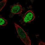 ONECUT3 Antibody in Immunocytochemistry (ICC/IF)