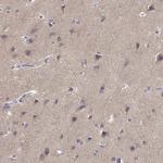 TMEM145 Antibody in Immunohistochemistry (IHC)