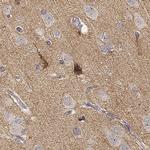 TMEM145 Antibody in Immunohistochemistry (IHC)