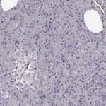 TMEM145 Antibody in Immunohistochemistry (IHC)