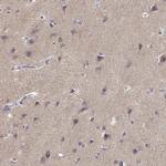 TMEM145 Antibody in Immunohistochemistry (IHC)