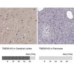 TMEM145 Antibody