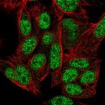 ZNF556 Antibody in Immunocytochemistry (ICC/IF)