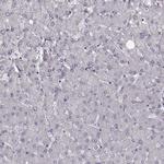 CCDC64 Antibody in Immunohistochemistry (IHC)