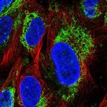 GluD1 Antibody in Immunocytochemistry (ICC/IF)