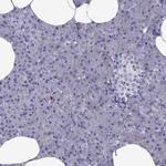 MYBPH Antibody in Immunohistochemistry (Paraffin) (IHC (P))