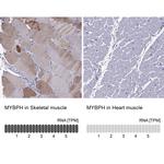 MYBPH Antibody in Immunohistochemistry (IHC)