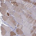 MYBPH Antibody in Immunohistochemistry (IHC)