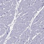 MYBPH Antibody in Immunohistochemistry (IHC)