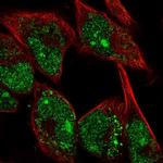 MYBPH Antibody in Immunocytochemistry (ICC/IF)