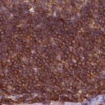 ARHGAP25 Antibody in Immunohistochemistry (Paraffin) (IHC (P))