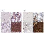 ARHGAP25 Antibody in Immunohistochemistry (IHC)