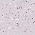 ARHGAP25 Antibody in Immunohistochemistry (IHC)