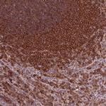 ARHGAP25 Antibody in Immunohistochemistry (IHC)