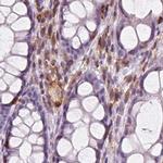 ARHGAP25 Antibody in Immunohistochemistry (IHC)