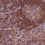 ARHGAP25 Antibody in Immunohistochemistry (IHC)