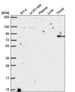 ARHGAP25 Antibody in Western Blot (WB)