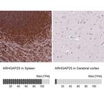 ARHGAP25 Antibody