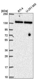 TRIM24 Antibody in Western Blot (WB)