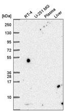 PCBD1 Antibody in Western Blot (WB)