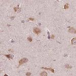 RPS5 Antibody in Immunohistochemistry (IHC)