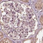 RPS5 Antibody in Immunohistochemistry (IHC)