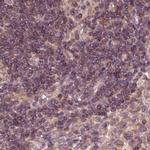 RPS5 Antibody in Immunohistochemistry (IHC)