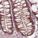 RPS5 Antibody in Immunohistochemistry (IHC)