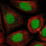 PHF8 Antibody in Immunocytochemistry (ICC/IF)