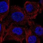 PPM1E Antibody in Immunocytochemistry (ICC/IF)