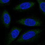 ALG6 Antibody in Immunocytochemistry (ICC/IF)