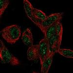 CTDSP1 Antibody in Immunocytochemistry (ICC/IF)