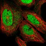 ATP5S Antibody in Immunocytochemistry (ICC/IF)