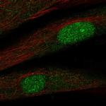 TWIST2 Antibody in Immunocytochemistry (ICC/IF)