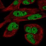 EYA3 Antibody in Immunocytochemistry (ICC/IF)