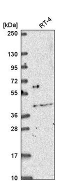 OSR2 Antibody in Western Blot (WB)