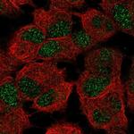 Lass6 Antibody in Immunocytochemistry (ICC/IF)