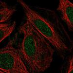 PFKFB2 Antibody in Immunocytochemistry (ICC/IF)