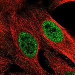 MED22 Antibody in Immunocytochemistry (ICC/IF)