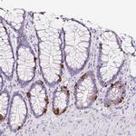 SLC18A1 Antibody in Immunohistochemistry (IHC)