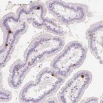 SLC18A1 Antibody in Immunohistochemistry (IHC)