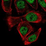 PUS3 Antibody in Immunocytochemistry (ICC/IF)