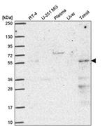 PUS3 Antibody in Western Blot (WB)