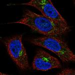 TMEM5 Antibody in Immunocytochemistry (ICC/IF)