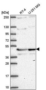 TMEM5 Antibody in Western Blot (WB)