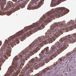 GTPBP1 Antibody in Immunohistochemistry (IHC)