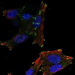 NEDD4L Antibody in Immunocytochemistry (ICC/IF)