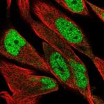 DCLRE1B Antibody in Immunocytochemistry (ICC/IF)